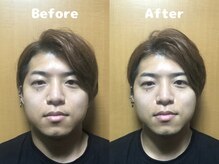 くにたちNyan鍼灸整体院/【小顔矯正】Before After 11