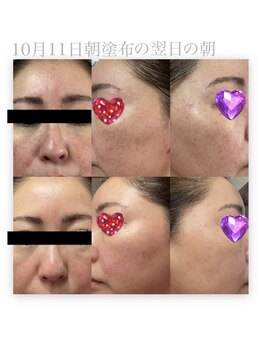 レクレア/エクソソーム原液