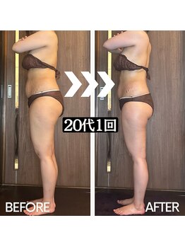 アーユルヴェーダアンドアロマエステ アユス(AYUS)/