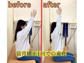 きずな鍼灸整骨院 武蔵ヶ丘本院/猫背矯正
