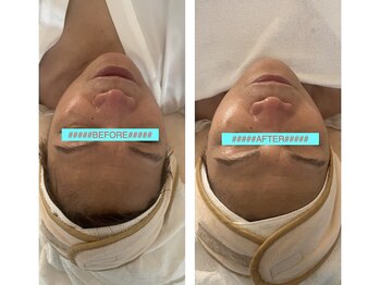 ミータイムコト(METIMEKOTO)/フェイシャルエステ