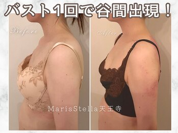マリスステラ 天王寺(MarisStella)/バストケアの変化♪