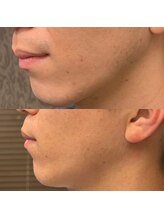 フェリーバ 浦和店(FELIVA)/Before&After