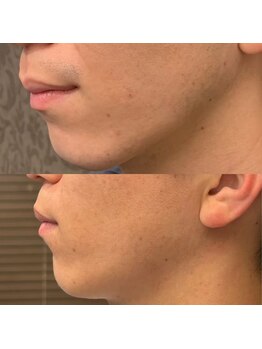 フェリーバ 浦和店(FELIVA)/Before&After