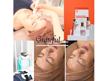 グレイティフル(Grateful)の写真