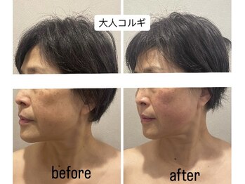 ラコル 京橋店(lacol)/【新メニュー】大人コルギ