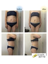 クリニカルエステ イーズ 広島祇園店/BODY★レモンボトル体験★