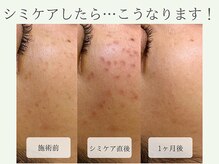 ポノ(Pono)の雰囲気（当日～メイクOK！1回で変化を実感♪効果には個人差があります。）