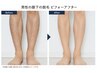 痛み最小×爆抜け!メンズ膝下脱毛体験 初回9900円