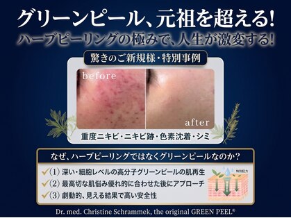 ナンバーナイン(N°9)の写真