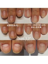 ニコプラス(NICO+)/パラジェルクリア補強