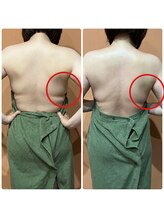 シエル(Ciel)/【次世代ハーブピーリング】