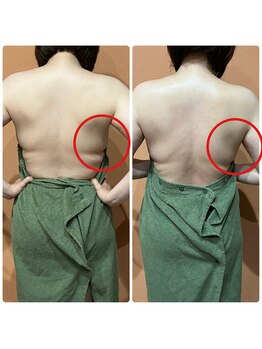 シエル(Ciel)/【次世代ハーブピーリング】