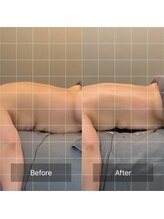 カシェットベルメイユ 名古屋久屋大通(Cachette Vermeil)/肩こり×冷え・睡眠にアプローチ