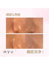 ミュー(professional beauty salon MYU)/黒ずみケアはプロにお任せあれ！
