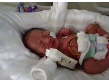 ボディラボらくなり/35週目緊急切開で誕生の双子