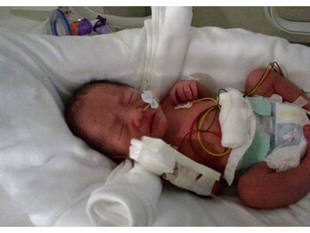 ボディラボらくなり/35週目緊急切開で誕生の双子