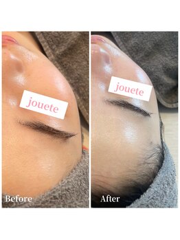 ジュエッテ(jouete)/圧倒的人気！水光白玉肌管理！