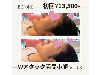 ウナ デ リンゴル 恵比寿店(UNA de Ringol)/当店1番人気小顔メニュー¥13500