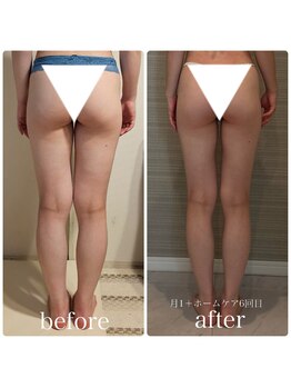 ブリス(BLiSS)/月1ペース♪