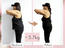 asmot鍼灸 整体院 代々木上原(asmot鍼灸 整体院)/【代々木上原】 &nbsp;鍼灸ダイエット