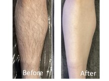 セブンボーテ(7Beaut'e)/メンズ脱毛も大歓迎♪