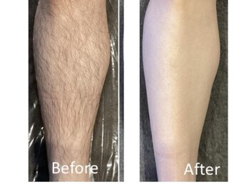 セブンボーテ(7Beaut'e)/メンズ脱毛も大歓迎♪