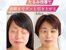 プルチャームエクイデム(Pulchram equidem)