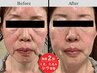 結果重視の最新美容液＆機器でシミ・シワ・肌質改善フェイシャル60分