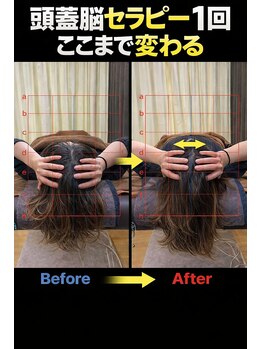 アンフィニ(Infini)/頭蓋脳セラピーbefore-after