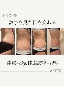 【よもぎ蒸し温活痩身×水素吸入】YOSAPARK ALUA FEM/ダイエットで悩ませない！