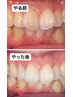 3回+歯のプレミアムペーストH.C付¥19,800