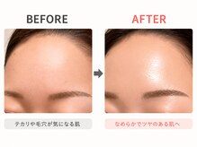 ハーゼ(Hase)/水光生美容液トリートメント