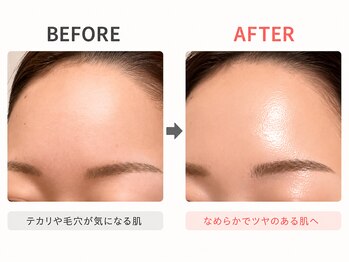 ハーゼ(Hase)/水光生美容液トリートメント