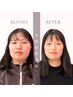 【たるみ改善・リフトアップ】小顔整体 初回体験