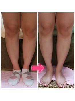 キレイとケンコウの応援サロン杉山/ふくらはぎの筋膜リリース30分