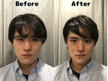 くにたちNyan鍼灸整体院/【小顔矯正】Before After 12