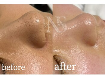 ナチュラ ソース(NatureSouce)