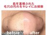 毛穴の詰まり・黒ずみを徹底除去!つるんとクリアの素肌へ☆
