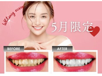 エクシアホワイトニング 明石店