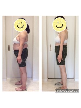 ホロニック ベルサンテ(Holonic Belle Sante)/メディセルハイブリッド