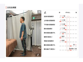 しじみ整体ラボ/2回目施術後の院長先生、横向き