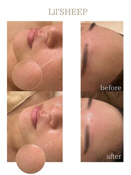 リルシープ(LIL'SHEEP)/陶肌ピール