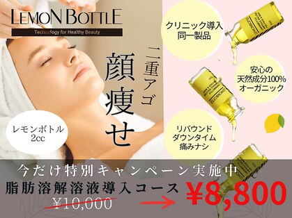 カリスボーテ 関本店の写真