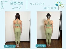 ボディコンディション/ウィンバック/痩身/小顔ラジオ波