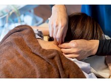 ウギィ(ugi-)/鍼灸施術　例2