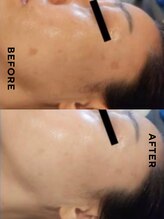 ココ ル メアリー アシヤ(COCO LE MARY ASHIYA)/Befor After