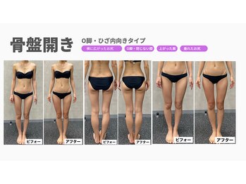 じぶんdeエステ 梅田店/CELLZERO.式症例8