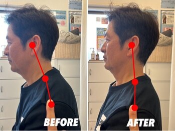 ながおけ式ゆらゆら整体 松山桑原院/ストレートネック改善