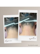ブラジリアンワキシング シックスナイン(BrazilianWaxing69)/女性 / うなじ